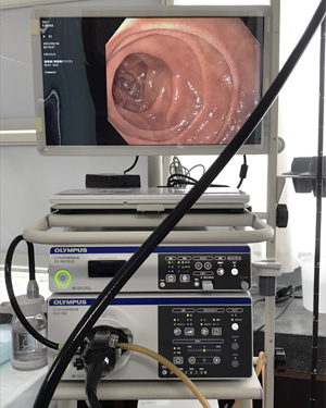 オリンパス 電子内視鏡システム EVIS EXERAⅢ